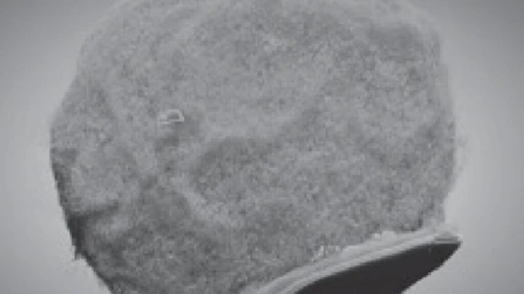 Tiny chips hitch a ride on immune cells to sites of inflammation